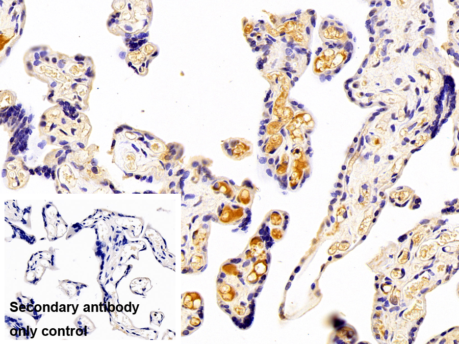 Monoclonal Antibody to Plasminogen Activator Inhibitor 1 (PAI1)