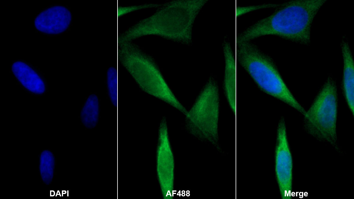 Monoclonal Antibody to Plasminogen Activator Inhibitor 1 (PAI1)