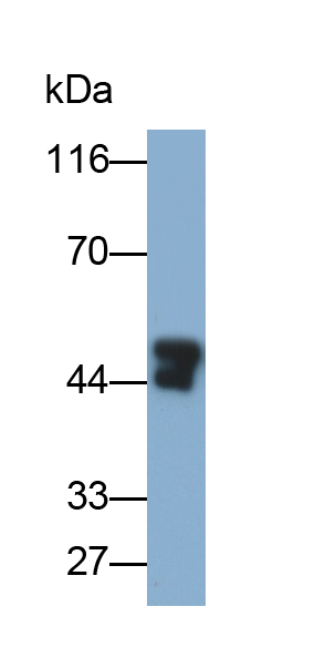 Monoclonal Antibody to Enolase, Neuron Specific (NSE)