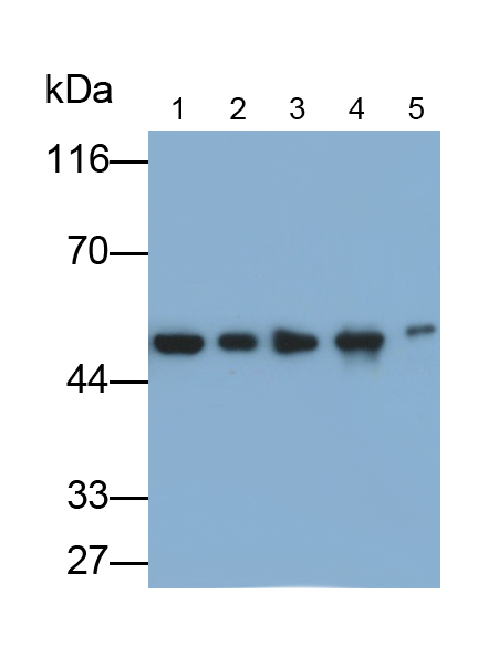 Monoclonal Antibody to Enolase, Neuron Specific (NSE)