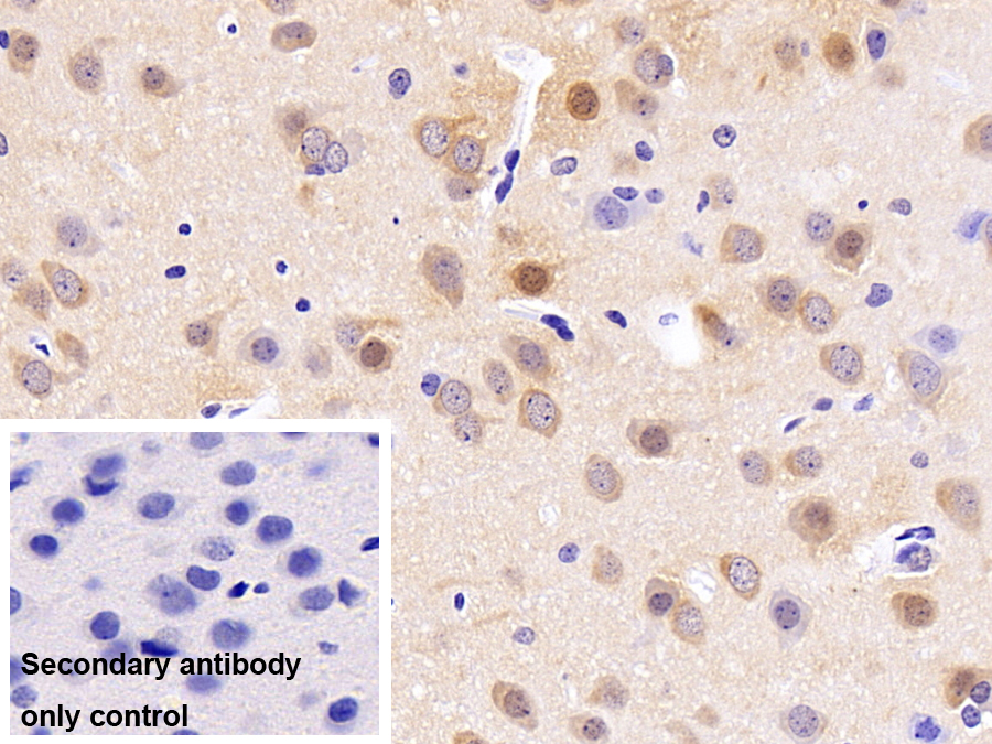 Monoclonal Antibody to Enolase, Neuron Specific (NSE)