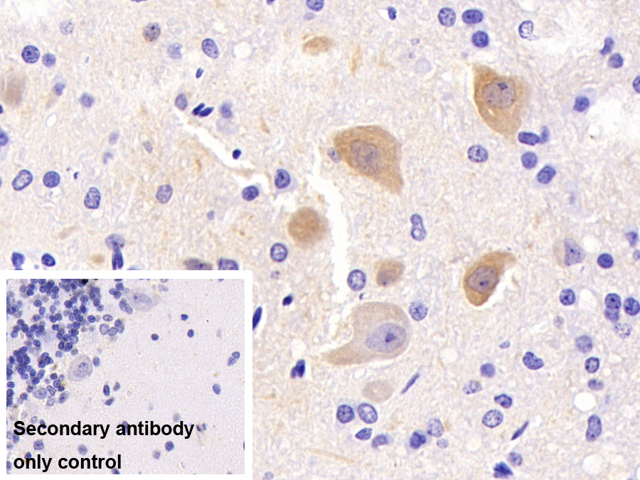 Monoclonal Antibody to Enolase, Neuron Specific (NSE)