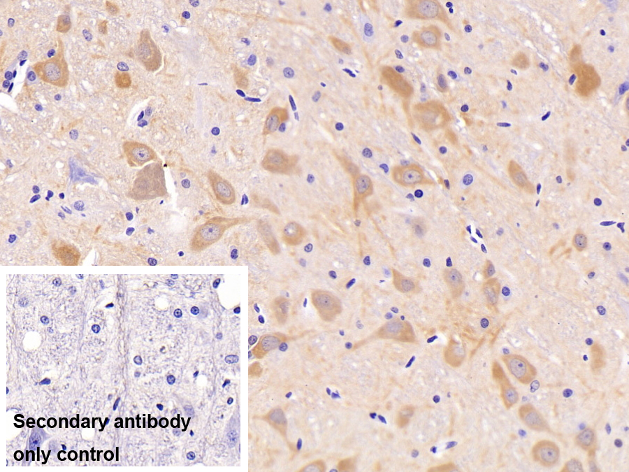 Monoclonal Antibody to Enolase, Neuron Specific (NSE)