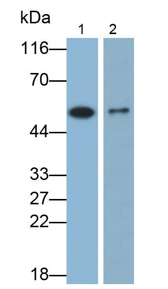 Monoclonal Antibody to Enolase, Neuron Specific (NSE)