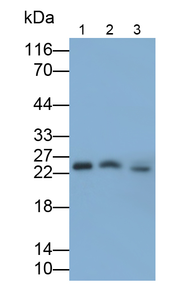 Monoclonal Antibody to Myelin Basic Protein (MBP)