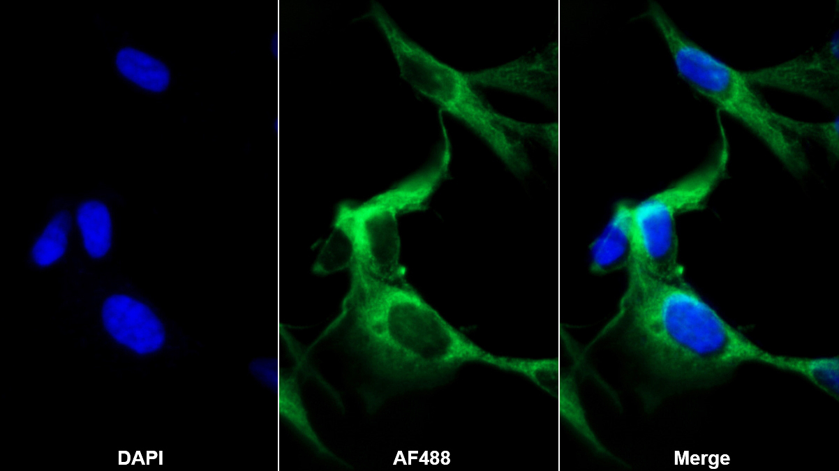 Monoclonal Antibody to Brain Natriuretic Peptide (BNP)