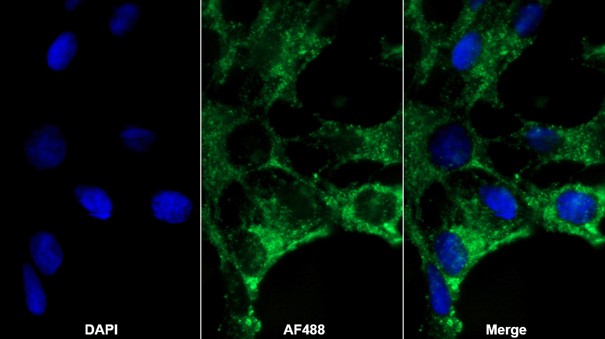 Monoclonal Antibody to Brain Natriuretic Peptide (BNP)