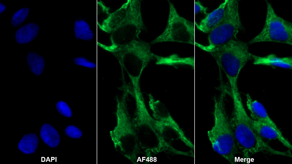 Monoclonal Antibody to Brain Natriuretic Peptide (BNP)