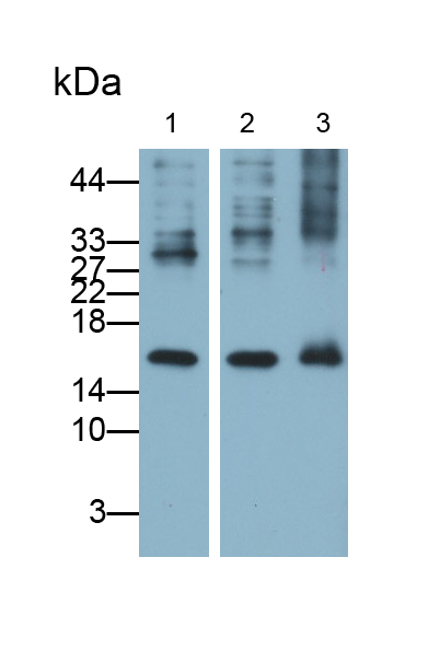 Monoclonal Antibody to Brain Natriuretic Peptide (BNP)