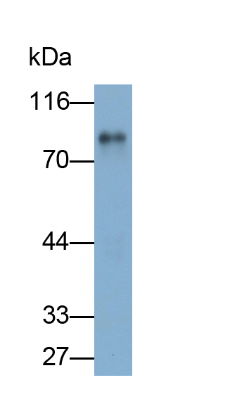 Monoclonal Antibody to Matrix Metalloproteinase 9 (MMP9)