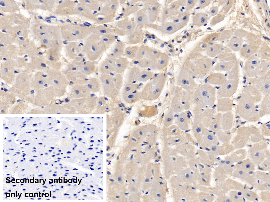 Monoclonal Antibody to Matrix Metalloproteinase 9 (MMP9)