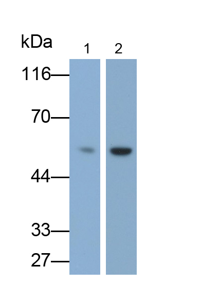 Monoclonal Antibody to Cytokeratin 7 (CK7)