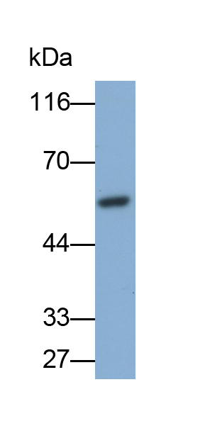 Monoclonal Antibody to Cytokeratin 7 (CK7)