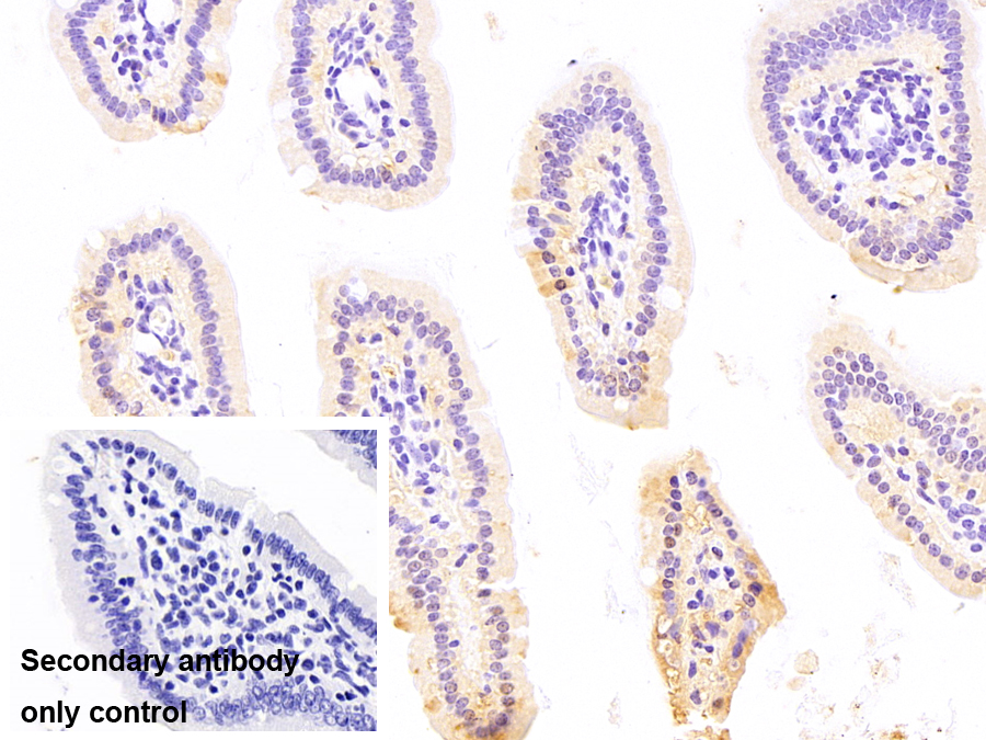 Monoclonal Antibody to Fatty Acid Binding Protein 2, Intestinal (FABP2)