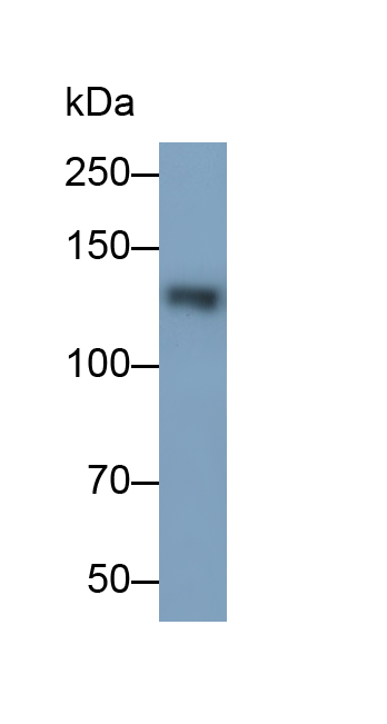 Monoclonal Antibody to Epidermal Growth Factor (EGF)