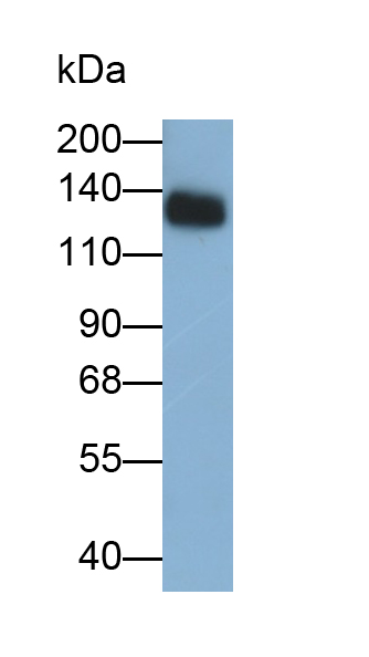 Monoclonal Antibody to Epidermal Growth Factor (EGF)