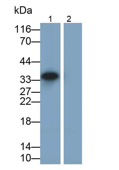 Monoclonal Antibody to Interleukin 1 Beta (IL1b)