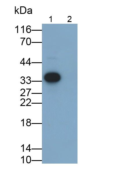 Monoclonal Antibody to Interleukin 1 Beta (IL1b)