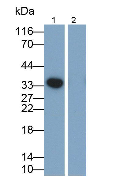 Monoclonal Antibody to Interleukin 1 Beta (IL1b)