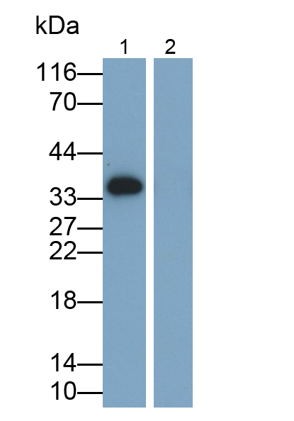 Monoclonal Antibody to Interleukin 1 Beta (IL1b)