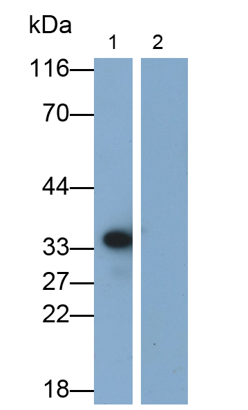 Monoclonal Antibody to Interleukin 1 Beta (IL1b)