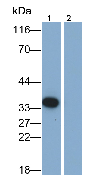 Monoclonal Antibody to Interleukin 1 Beta (IL1b)