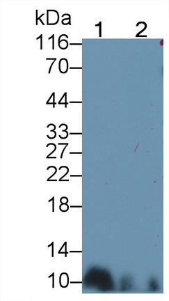 Monoclonal Antibody to S100 Calcium Binding Protein B (S100B)