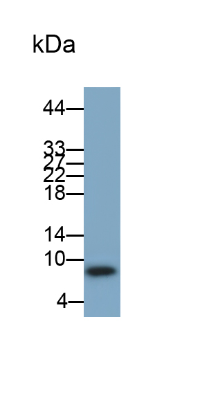 Monoclonal Antibody to S100 Calcium Binding Protein B (S100B)