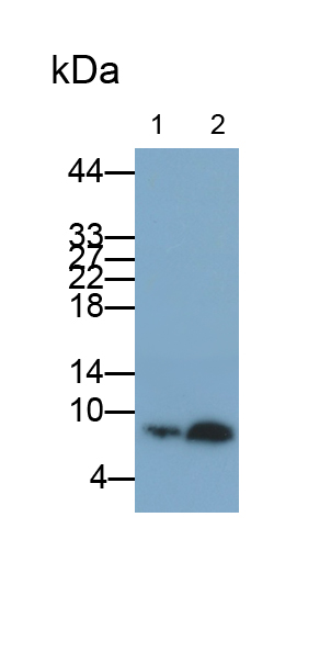 Monoclonal Antibody to S100 Calcium Binding Protein B (S100B)