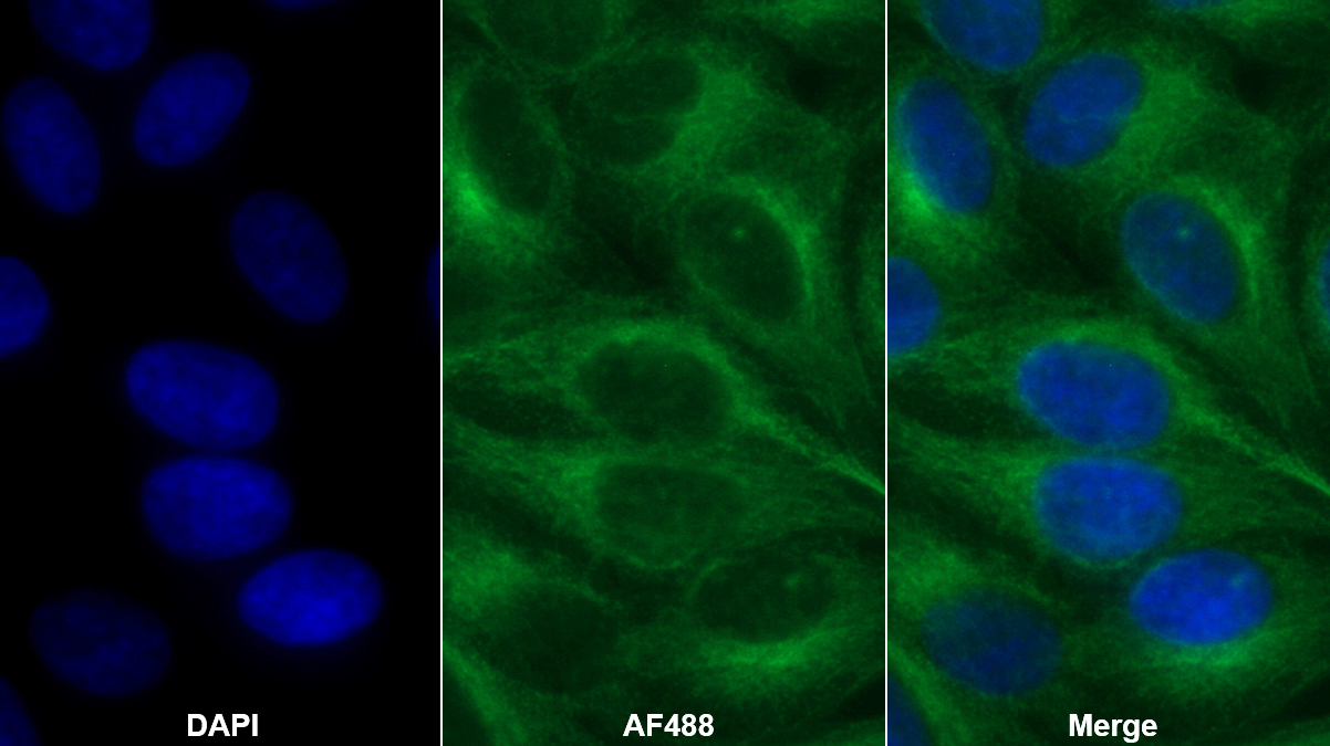 Monoclonal Antibody to Procollagen III N-Terminal Propeptide (PIIINP)