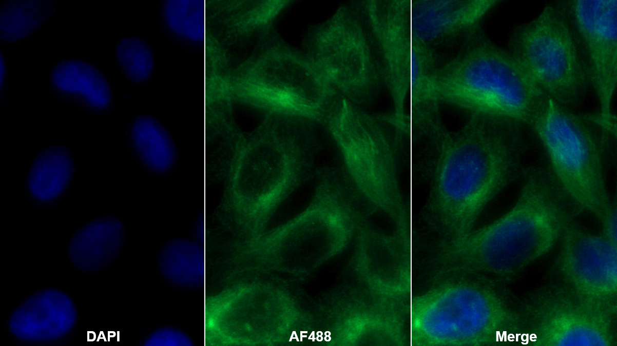 Monoclonal Antibody to Procollagen III N-Terminal Propeptide (PIIINP)