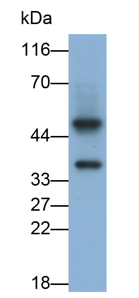 Monoclonal Antibody to Aquaporin 4 (AQP4)