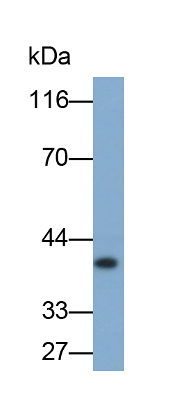 Monoclonal Antibody to Aquaporin 4 (AQP4)