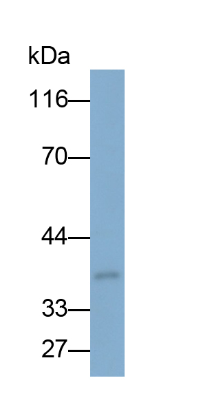 Monoclonal Antibody to Aquaporin 4 (AQP4)