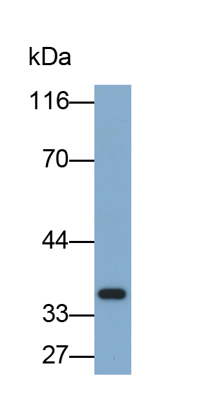 Monoclonal Antibody to Aquaporin 4 (AQP4)