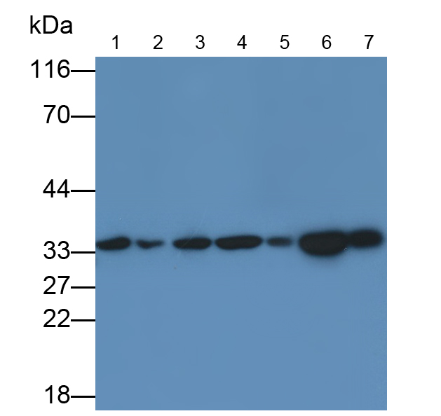 Monoclonal Antibody to Proliferating Cell Nuclear Antigen (PCNA)