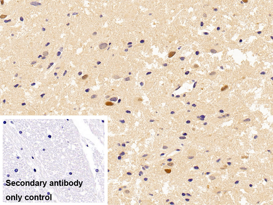 Monoclonal Antibody to Proliferating Cell Nuclear Antigen (PCNA)