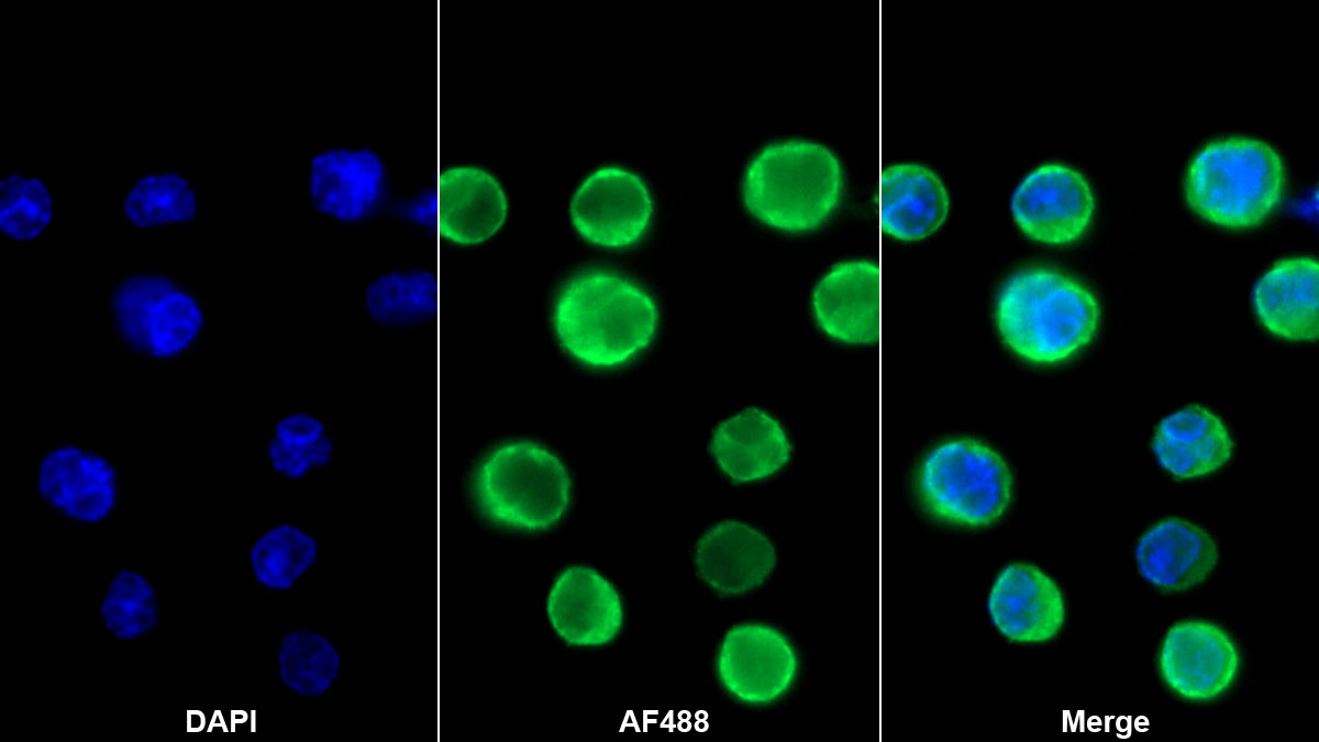 Monoclonal Antibody to Myeloperoxidase (MPO)