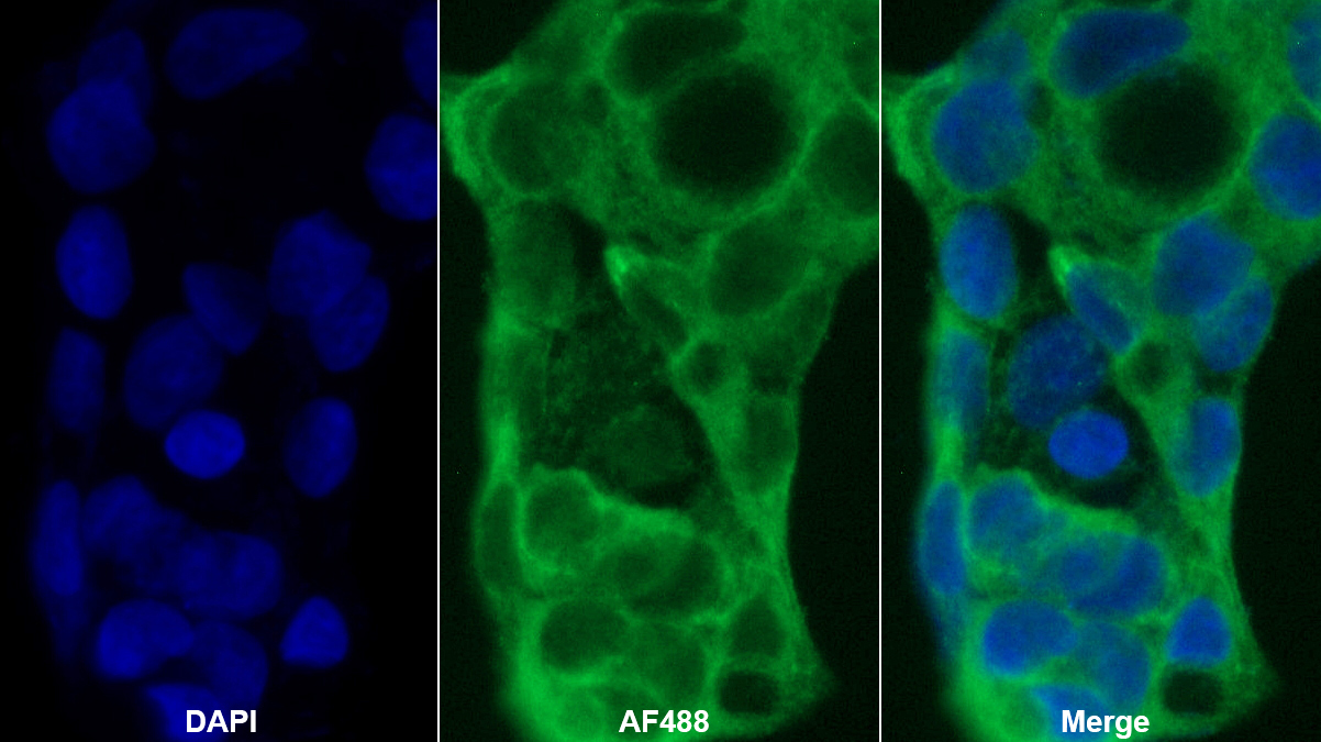 Monoclonal Antibody to Apolipoprotein B100 (APOB100)