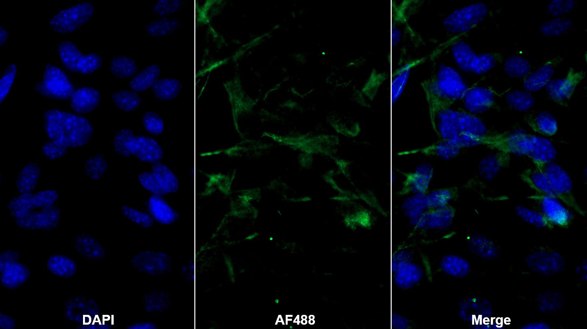 Monoclonal Antibody to Adiponectin (ADPN)