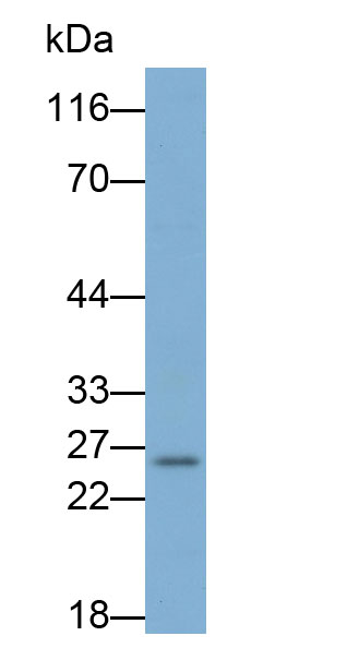 Monoclonal Antibody to Glutathione S Transferase Alpha 1 (GSTa1)