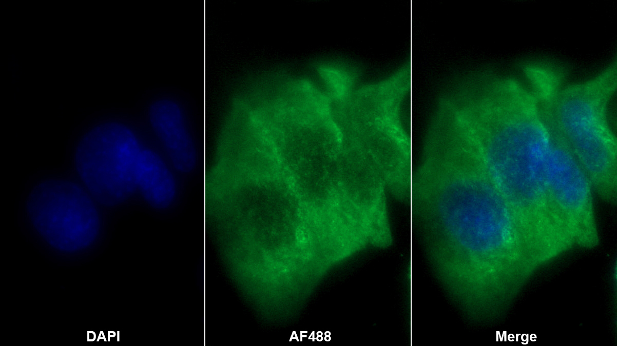 Monoclonal Antibody to Transcription Factor P65 (NFKB3)