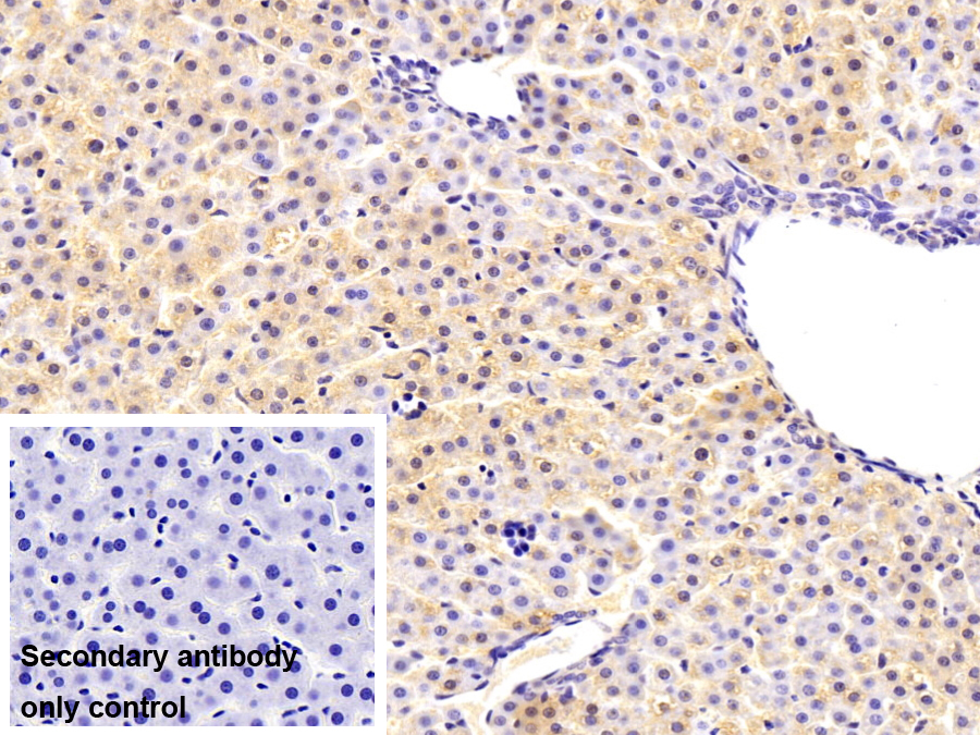 Monoclonal Antibody to Complement Factor H (CFH)