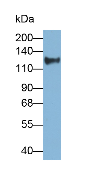 Monoclonal Antibody to Complement Factor H (CFH)