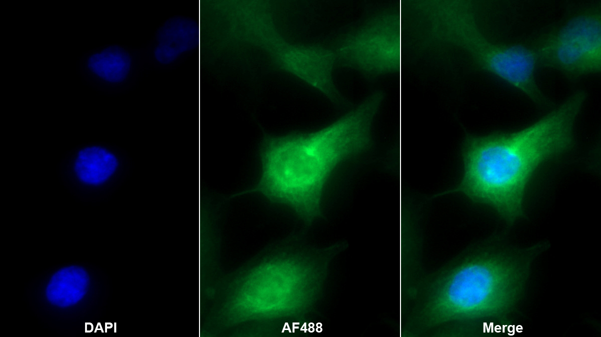 Monoclonal Antibody to Complement component 1 Q subcomponent-binding protein, mitochondrial (C1QBP)