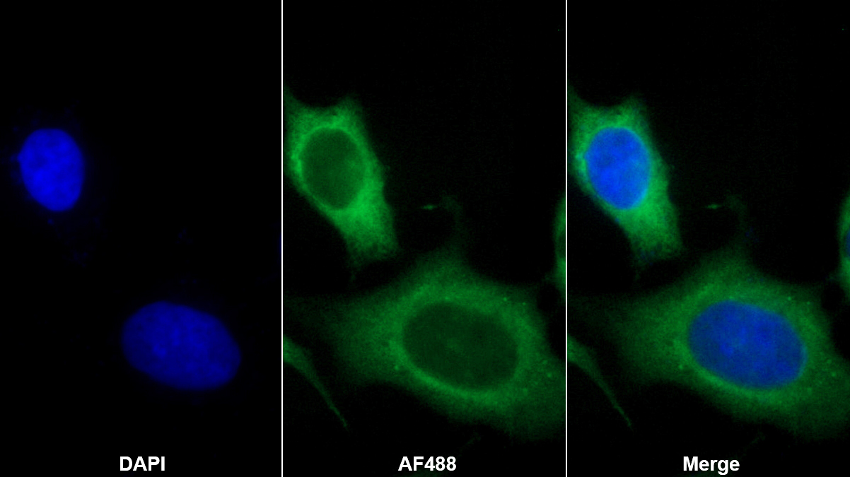 Monoclonal Antibody to Interleukin 7 (IL7)