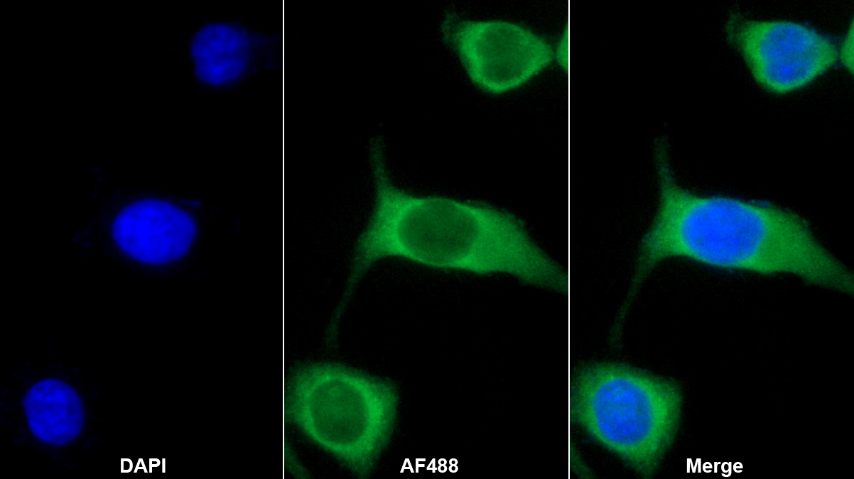 Monoclonal Antibody to Interleukin 7 (IL7)