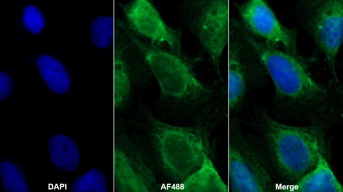 Monoclonal Antibody to Cross Linked C-Telopeptide Of Type I Collagen (CTXI)