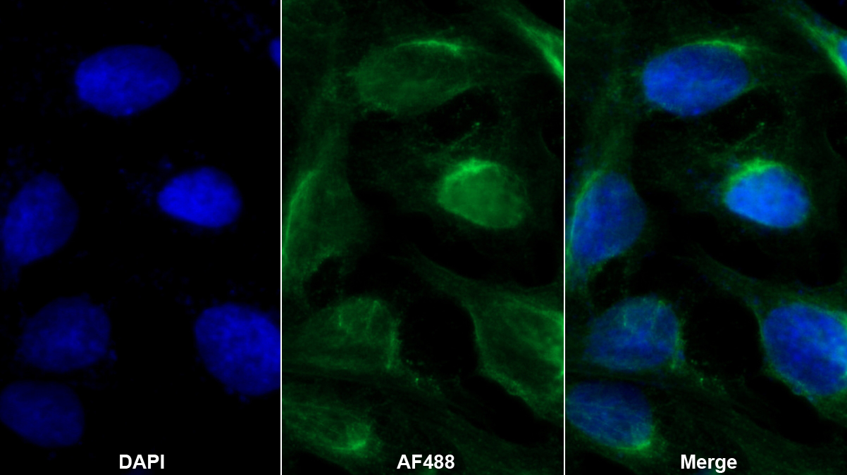 Monoclonal Antibody to Cross Linked C-Telopeptide Of Type I Collagen (CTXI)