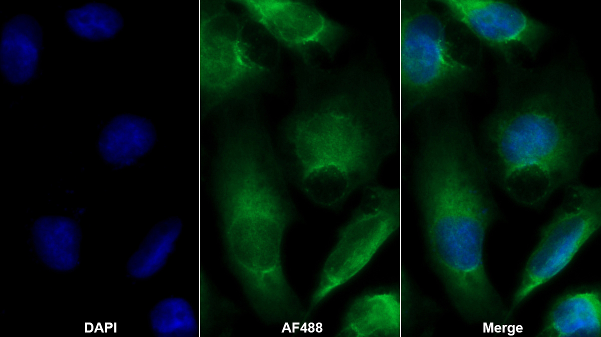 Monoclonal Antibody to Cross Linked C-Telopeptide Of Type I Collagen (CTXI)